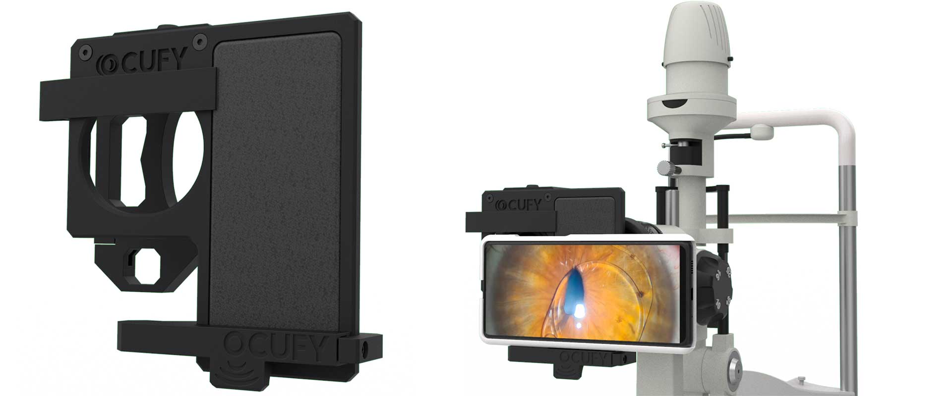 Slit Lamp iPhone Adapters: A Cost-Effective Alternative to Expensive Slit Lamp Cameras
